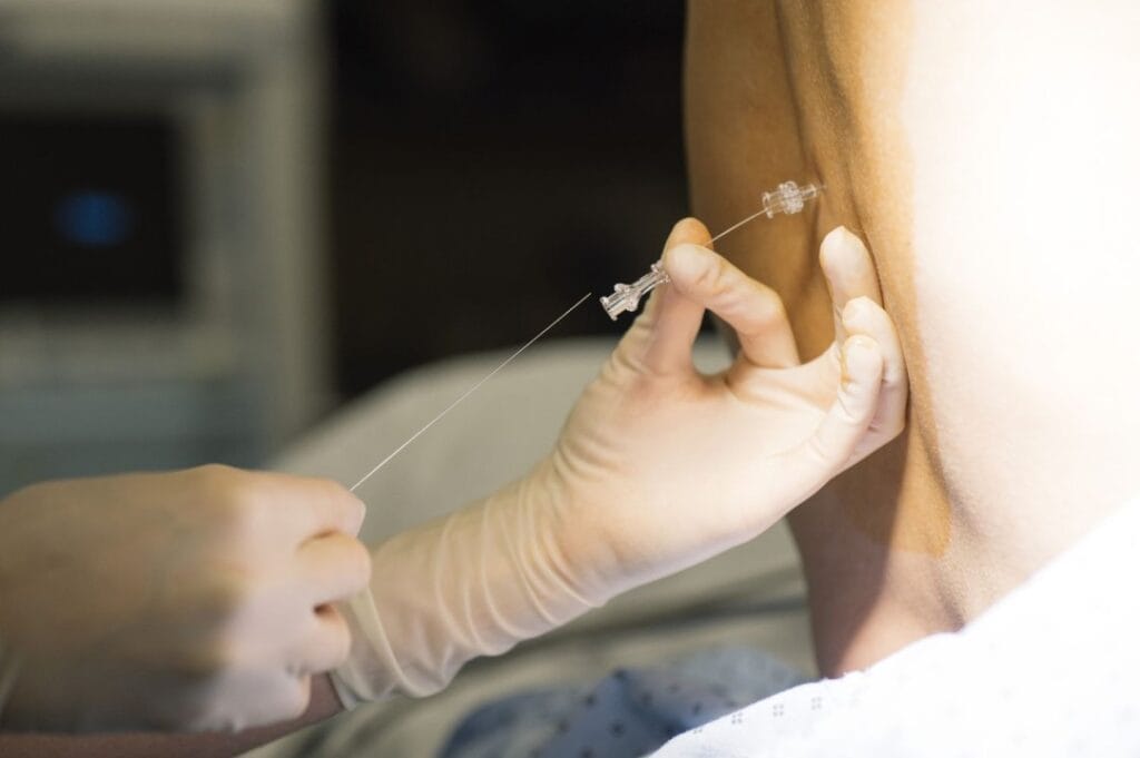 Expert Epidurals in Metro Detroit, MI