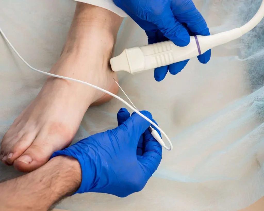 Radiofrequency ablation ankle 1500x1200 1