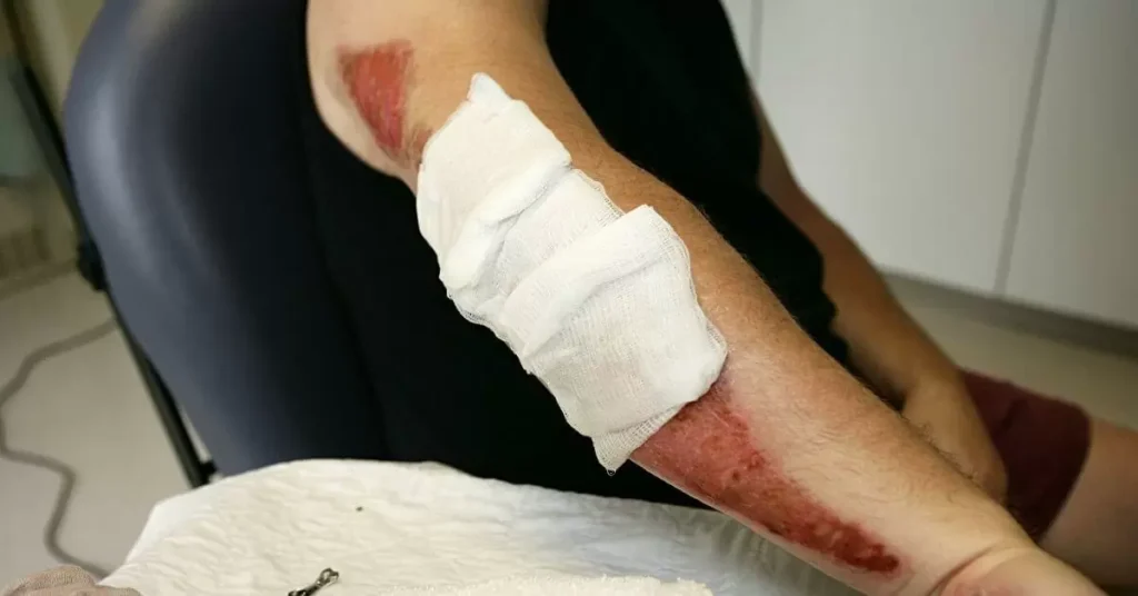 Expert Care for Auto Accident Injuries At Specialty Pain Center
