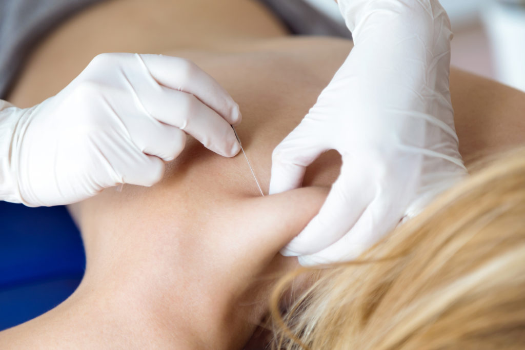 Interventional Treatment