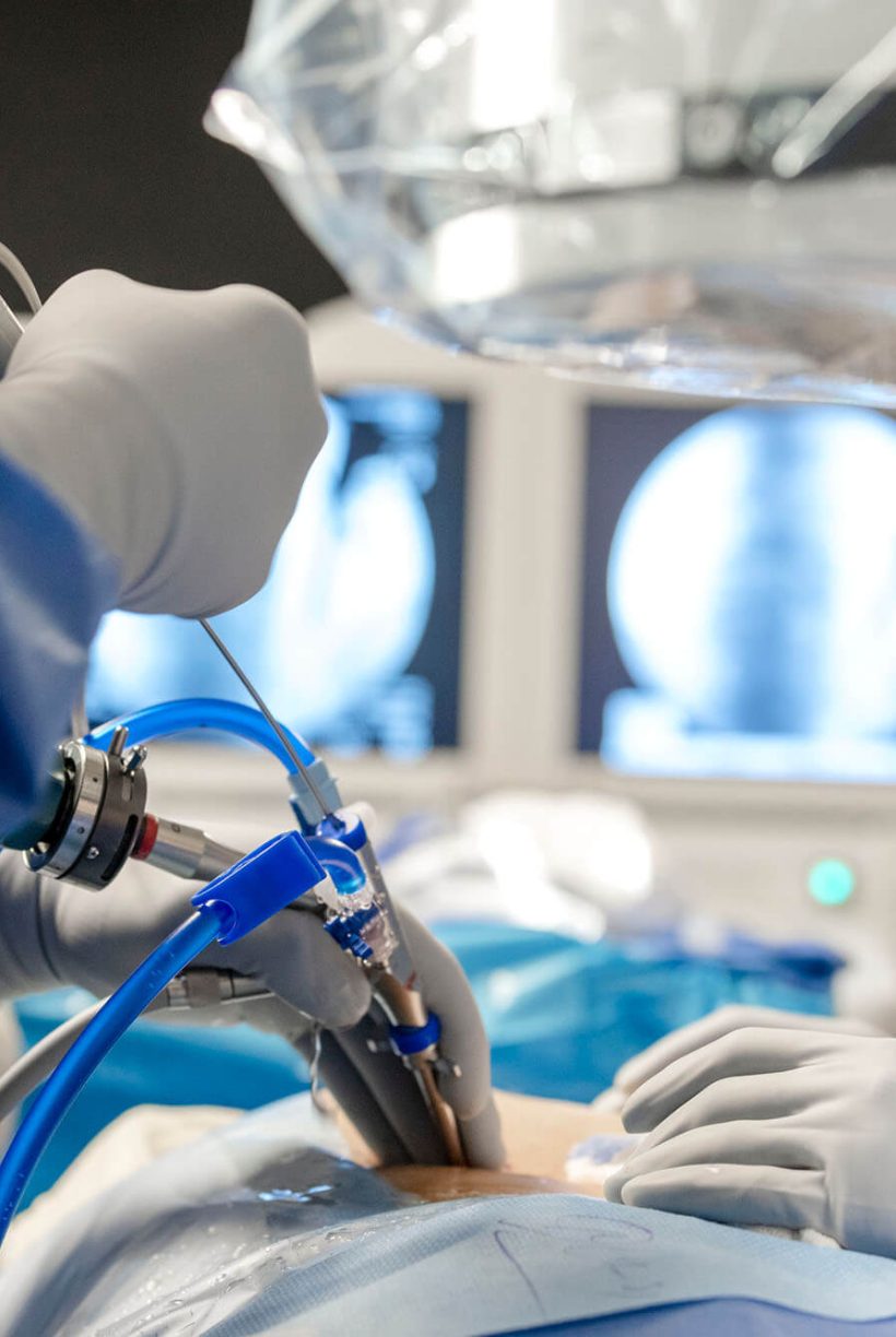 Interventional Treatment